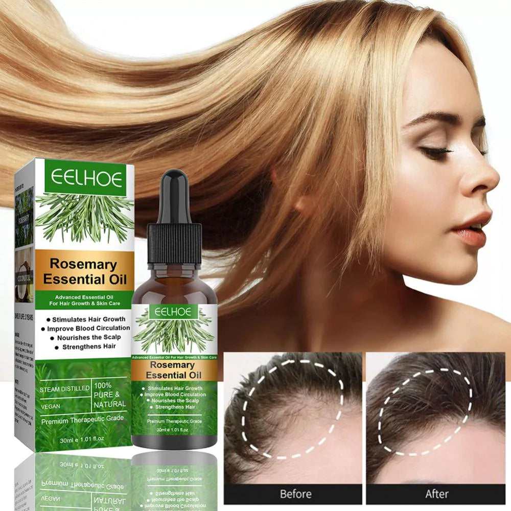 Sérum De Romero Anticaída — Crecimiento Capilar Natural