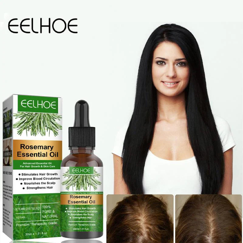 Sérum De Romero Anticaída — Crecimiento Capilar Natural