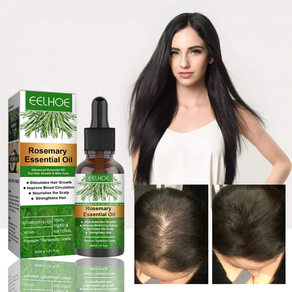 Sérum De Romero Anticaída — Crecimiento Capilar Natural